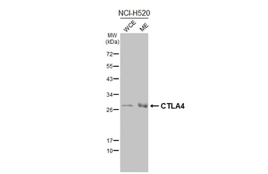 Anti-CTLA4 antibody [HL2732] used in Western Blot (WB). GTX639560