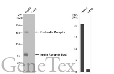 Anti-Insulin Receptor beta antibody [HL2737] used in Western Blot (WB). GTX639566