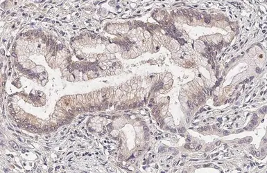 Anti-Insulin Receptor beta antibody [HL2737] used in IHC (Paraffin sections) (IHC-P). GTX639566