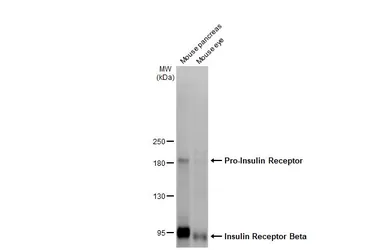 Anti-Insulin Receptor beta antibody [HL2737] used in Western Blot (WB). GTX639566