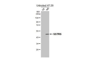 Anti-SSTR5 antibody [HL2756] used in Western Blot (WB). GTX639619