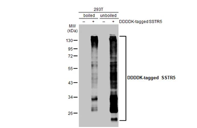 Anti-SSTR5 antibody [HL2756] used in Western Blot (WB). GTX639619