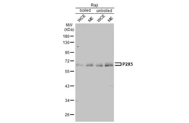 Anti-P2X5 antibody [HL2773] used in Western Blot (WB). GTX639638