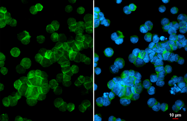 Anti-P2X5 antibody [HL2773] used in Immunocytochemistry/ Immunofluorescence (ICC/IF). GTX639638