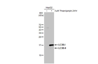 Anti-LC3B antibody [HL2798] used in Western Blot (WB). GTX639686