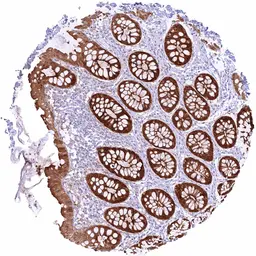 Anti-GPX2 antibody [HMV301] HistoMAX&trade; used in IHC (Paraffin sections) (IHC-P). GTX639924