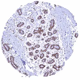 Anti-Glucocorticoid Receptor antibody [HMV304] HistoMAX&trade; used in IHC (Paraffin sections) (IHC-P). GTX639927