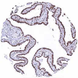 Anti-Glucocorticoid Receptor antibody [HMV304] HistoMAX&trade; used in IHC (Paraffin sections) (IHC-P). GTX639927