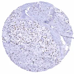 Anti-Glucocorticoid Receptor antibody [HMV304] HistoMAX&trade; used in IHC (Paraffin sections) (IHC-P). GTX639927