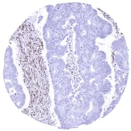 Anti-Glucocorticoid Receptor antibody [HMV304] HistoMAX&trade; used in IHC (Paraffin sections) (IHC-P). GTX639927