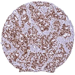 Anti-Glucocorticoid Receptor antibody [HMV304] HistoMAX&trade; used in IHC (Paraffin sections) (IHC-P). GTX639927