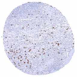 Anti-Thymidylate synthase antibody [HMV305] HistoMAX&trade; used in IHC (Paraffin sections) (IHC-P). GTX639929