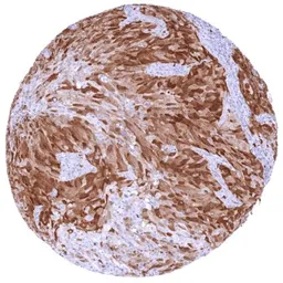 Anti-Thymidylate synthase antibody [HMV305] HistoMAX&trade; used in IHC (Paraffin sections) (IHC-P). GTX639929