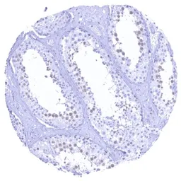 Anti-Thymidylate synthase antibody [HMV305] HistoMAX&trade; used in IHC (Paraffin sections) (IHC-P). GTX639929