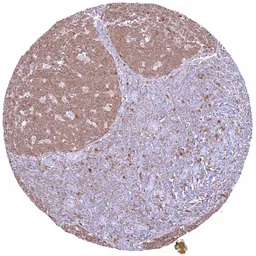 Anti-Caspase 3 antibody [HMV307] HistoMAX&trade; used in IHC (Paraffin sections) (IHC-P). GTX639931