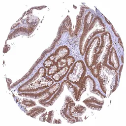 Anti-Caspase 3 antibody [HMV307] HistoMAX&trade; used in IHC (Paraffin sections) (IHC-P). GTX639931