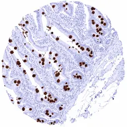 Anti-MUC2 antibody [HMV310] HistoMAX&trade; used in IHC (Paraffin sections) (IHC-P). GTX639934