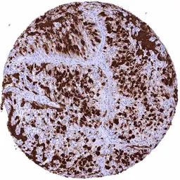 Anti-MUC2 antibody [HMV310] HistoMAX&trade; used in IHC (Paraffin sections) (IHC-P). GTX639934