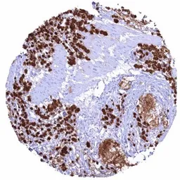 Anti-MUC2 antibody [HMV310] HistoMAX&trade; used in IHC (Paraffin sections) (IHC-P). GTX639934