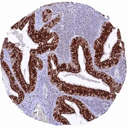 Anti-SDHB antibody [HMV320] HistoMAX&trade; used in IHC (Paraffin sections) (IHC-P). GTX639944