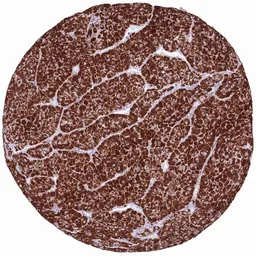 Anti-SDHB antibody [HMV320] HistoMAX&trade; used in IHC (Paraffin sections) (IHC-P). GTX639944