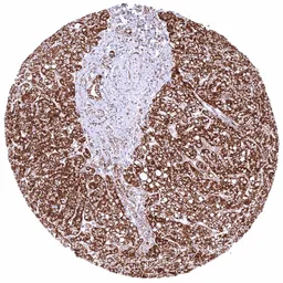 Anti-SDHB antibody [HMV320] HistoMAX&trade; used in IHC (Paraffin sections) (IHC-P). GTX639944