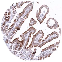 Anti-SDHB antibody [HMV320] HistoMAX&trade; used in IHC (Paraffin sections) (IHC-P). GTX639944