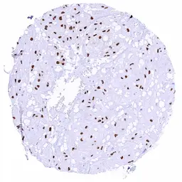 Anti-Brachyury antibody [HMV321] HistoMAX&trade; used in IHC (Paraffin sections) (IHC-P). GTX639945