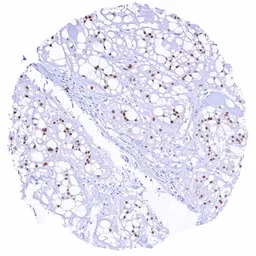 Anti-Brachyury antibody [HMV321] HistoMAX&trade; used in IHC (Paraffin sections) (IHC-P). GTX639945