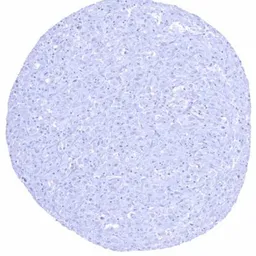 Anti-Brachyury antibody [HMV321] HistoMAX&trade; used in IHC (Paraffin sections) (IHC-P). GTX639945