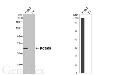 Anti-PCSK9 antibody [HL2815] used in Western Blot (WB). GTX639956