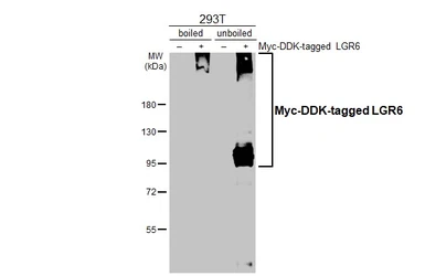 Anti-LGR6 antibody [HL2827] used in Western Blot (WB). GTX640098