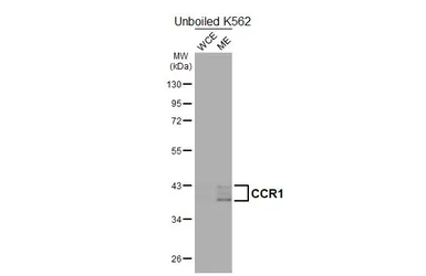 Anti-CCR1 antibody [HL2840] used in Western Blot (WB). GTX640111