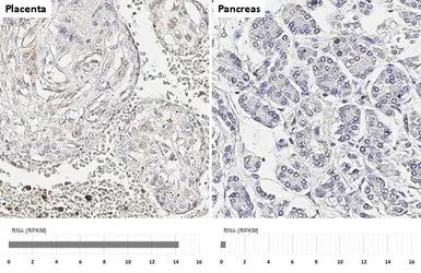 Anti-CCR1 antibody [HL2840] used in IHC (Paraffin sections) (IHC-P). GTX640111