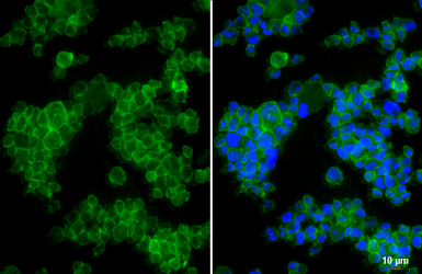 Anti-CCR1 antibody [HL2840] used in Immunocytochemistry/ Immunofluorescence (ICC/IF). GTX640111