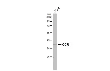 Anti-CCR1 antibody [HL2840] used in Western Blot (WB). GTX640111