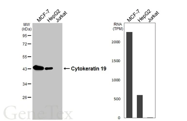 Anti-Cytokeratin 19 antibody [HL2878] used in Western Blot (WB). GTX640155