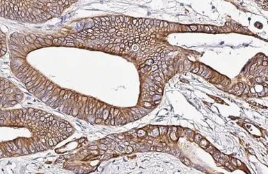 Anti-Cytokeratin 19 antibody [HL2878] used in IHC (Paraffin sections) (IHC-P). GTX640155