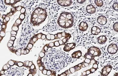 Anti-Cytokeratin 19 antibody [HL2878] used in IHC (Paraffin sections) (IHC-P). GTX640155