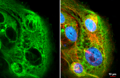 Anti-Cytokeratin 19 antibody [HL2878] used in Immunocytochemistry/ Immunofluorescence (ICC/IF). GTX640155