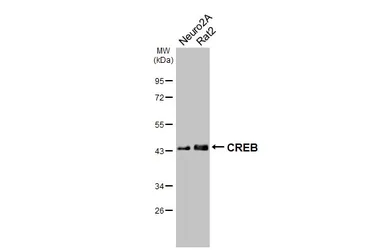 Anti-CREB antibody [HL2879] used in Western Blot (WB). GTX640158