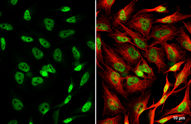 Anti-CREB antibody [HL2879] used in Immunocytochemistry/ Immunofluorescence (ICC/IF). GTX640158