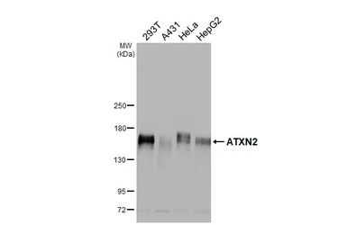 Anti-ATXN2 antibody [HL2885] used in Western Blot (WB). GTX640164