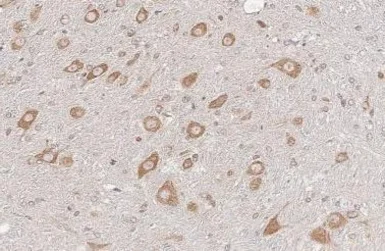 Anti-ATXN2 antibody [HL2885] used in IHC (Paraffin sections) (IHC-P). GTX640164