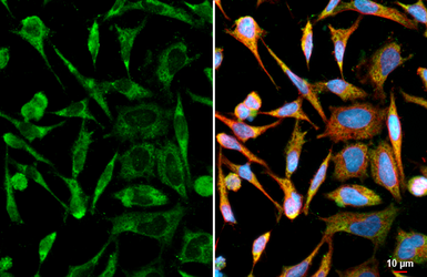 Anti-ATXN2 antibody [HL2885] used in Immunocytochemistry/ Immunofluorescence (ICC/IF). GTX640164