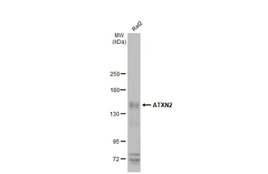 Anti-ATXN2 antibody [HL2885] used in Western Blot (WB). GTX640164