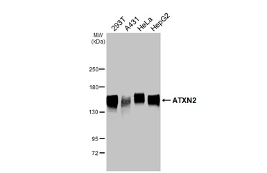 Anti-ATXN2 antibody [HL2886] used in Western Blot (WB). GTX640165