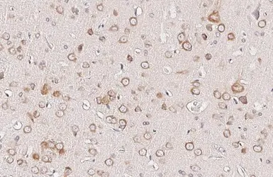 Anti-ATXN2 antibody [HL2886] used in IHC (Paraffin sections) (IHC-P). GTX640165