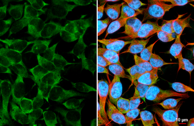 Anti-ATXN2 antibody [HL2886] used in Immunocytochemistry/ Immunofluorescence (ICC/IF). GTX640165