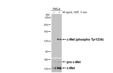 Anti-c-Met (phospho Tyr1234) antibody [HL2907] used in Western Blot (WB). GTX640244